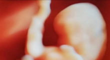 1556638423_trudnoća 4D 3D ultrazvučni pregled do 9 nedelje trudnoće galerija 11