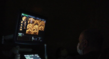 1585328091_41.trudnoca ekspertski 4D ultrazvuk od 20 24 nedelje trudnoce galerija