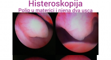 1599765213_01.Hysteroscopy gallery