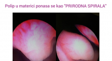 1599765221_08.Hysteroscopy gallery