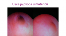 1599765222_09.Hysteroscopy gallery