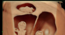1599765226_12.Hysteroscopy gallery